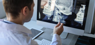 lateral view of a male radiologist examining neck x-rays